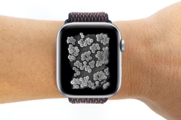 Estudio alerta: casi todas las correas de relojes inteligentes están contaminadas con bacterias