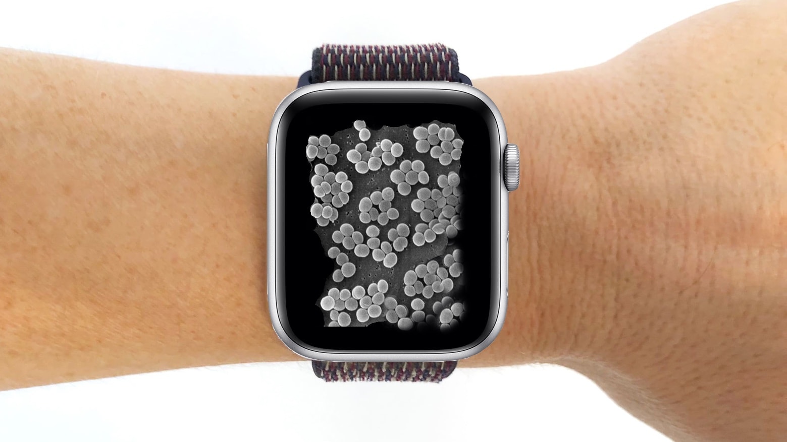 Estudio alerta: casi todas las correas de relojes inteligentes están contaminadas con bacterias