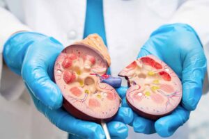 Brote de sarampión en México suma casi 7 mil casos en 2026; autoridades reportan 34 defunciones acumuladas