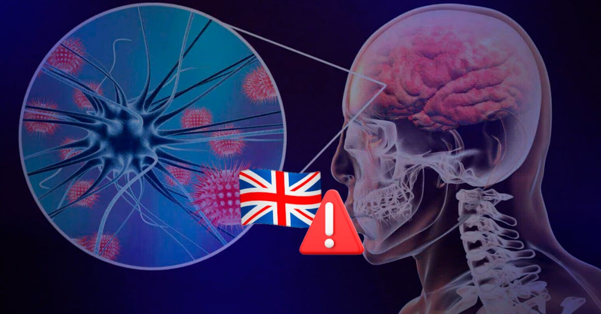 Brote de meningitis en Reino Unido deja dos muertos y obliga a vacunar a miles de estudiantes