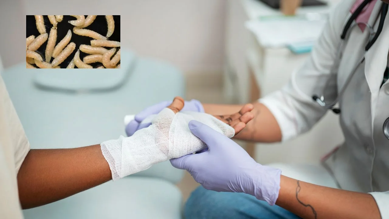 Reportan casos de miasis por gusano barrenador en humanos atendidos en la CDMX