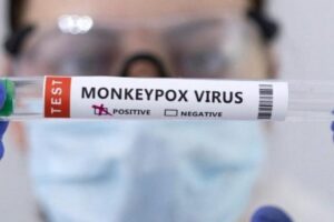 Acusan a dos científicos de contrabandear virus de viruela del mono a EE.UU.