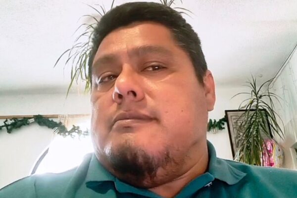Realizan cirugía maxilofacial exitosa para retirar tumor mandibular en IMSS Veracruz