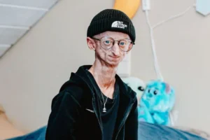 Muere Michiel Vandeweert, influencer belga con progeria que superó el pronóstico de vida