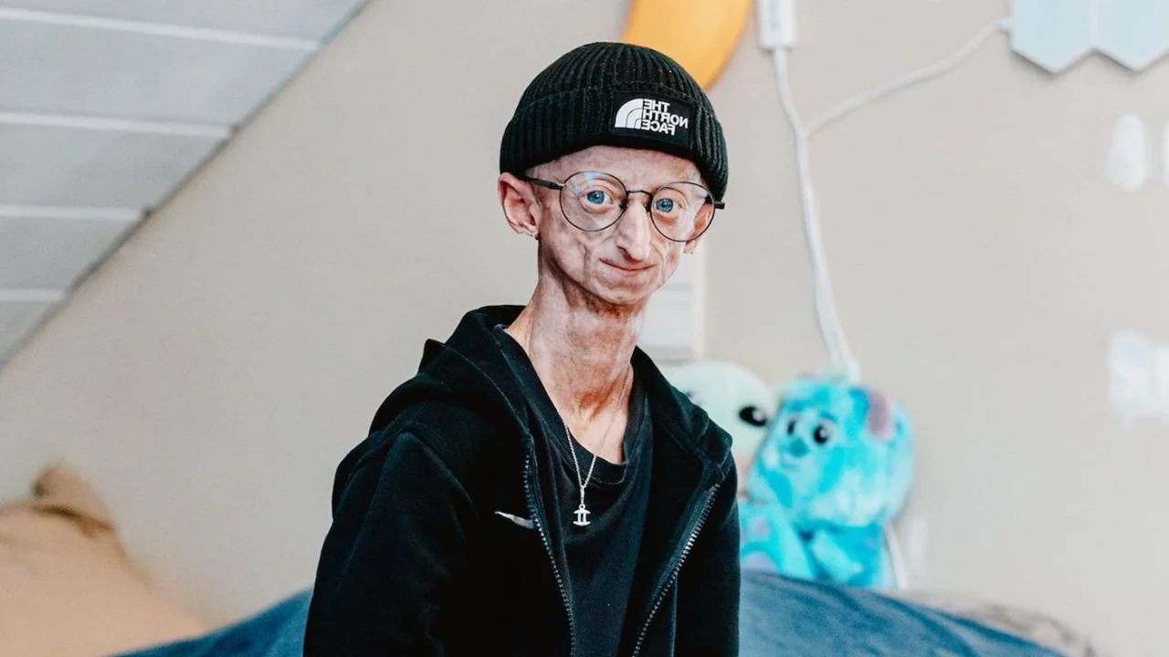 Muere Michiel Vandeweert, influencer belga con progeria que superó el pronóstico de vida
